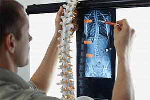 Scoliosis Physiotherapy - IRHC