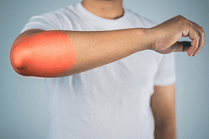 Physiotherapy 22 Rotator Cuff Injury Whiplash Physiotherapy - IRHC