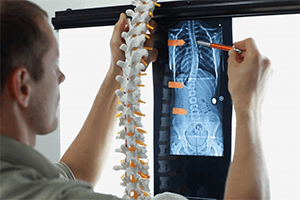 Physiotherapy 24 Scoliosis Physiotherapy - IRHC